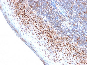 IHC testing of FFPE human tonsil with recombinant MCM7 antibody. Required HIER: boil tissue sections