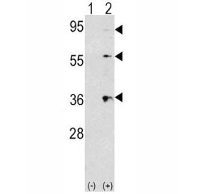 Thrombopoietin Antibody / THPO, 0.4ml