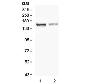Western blot testing of human 1) HEK293 and 2) U-87 MG cell lysate with CRB1 antibody. Predicted mol
