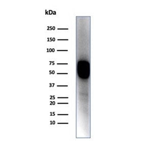 Western blot testing of A431 cell lysate with KRT14 antibody (clone KRT14/4128). Predicted molecular