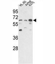 PPP3CC Antibody