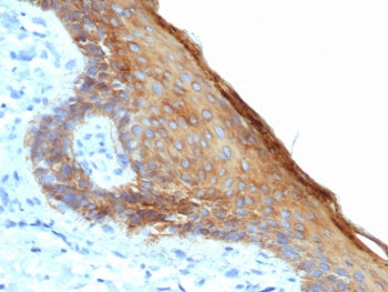 IHC staining of FFPE human skin with recombinant Basic Cytokeratin antibody (clone rKRTH/6617). HIER