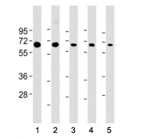 Western blot testing of PSMD3 antibody at 1:2000: Lane 1) human Jurkat, 2) (h) HeLa, 3) (h) HepG2, 4
