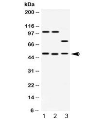 Western blot testing of 1) rat brain, 2) mouse brain and 3) human HeLa lysate with AZIN2 antibody at