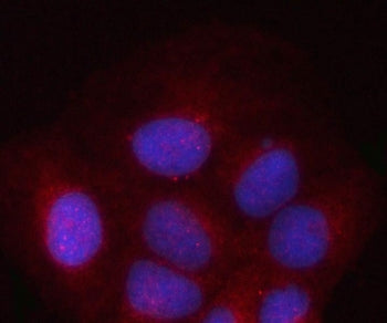 PSMD2&nbsp;Antibody / 26S proteasome non-ATPase regulatory subunit 2 / TRAP2