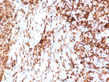 IHC staining of FFPE human tonsil tissue with HLA-DR antibody (clone HLA-DRA/6840R). HIER: boil tiss
