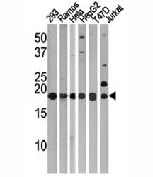 LC3C Antibody (MAP1LC3C)