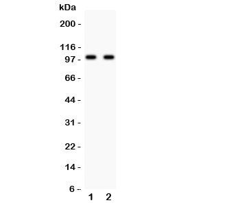 Western blot testing of Glutamate receptor 3 antibody and Lane 1: rat brain; 2: mouse brain lysate. 