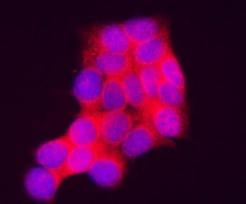 Immunofluorescent staining of FFPE human MCF7 cells with INPP4A antibody (red) and DAPI nuclear stai
