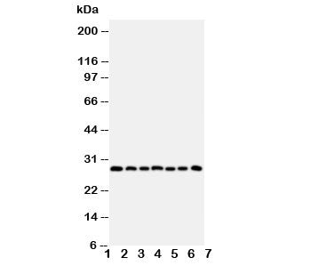 Western blot testing of Kallikrein-11 antibody and Lane 1: U87; 2: A549; 3: HeLa; 4: MM231; 5: MM453