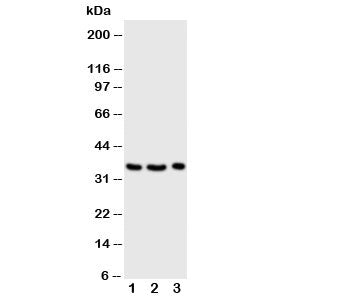 Western blot testing of Granzyme A antibody and Lane 1: Jurkat; 2: CEM; 3: Raji cell lysate