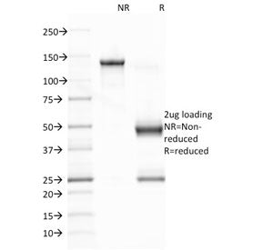 SDS-PAGE analysis of purified, BSA-free Epstein-Barr Virus antibody (clone CS1) as confirmation of i