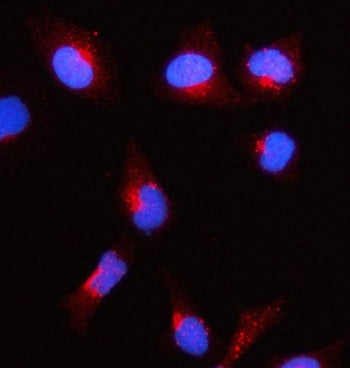 Immunofluorescent staining of FFPE human HeLa cells with Acetyl-CoA acetyltransferase antibody (red)