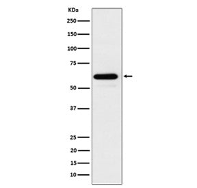Western blot analysis of HRPT2/CDC73 expression in 293T cell lysate using CDC73 antibody. Predicted 