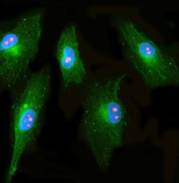 Immunofluorescent staining of FFPE human U-87 MG cells with NPP1 antibody (red), Beta Tubulin mAb (g