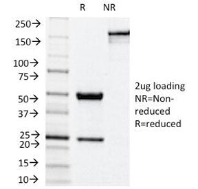 SDS-PAGE Analysis of Purified, BSA-Free NOX4 Antibody (clone NOX4/1245). Confirmation of Integrity a