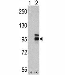 FGFR4 Antibody