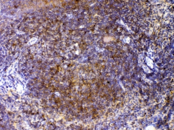 IHC testing of FFPE mouse spleen tissue with CTLA-4 antibody at 1ug/ml. Required HIER: steam section