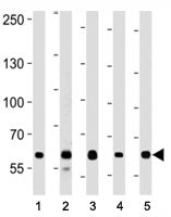 FOXP1 antibody western blot analysis in (1) A549, (2) Daudi, (3) Jurkat, (4) MCF-7, and (5) NCI-H292