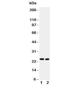 IL6 Antibody