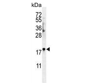 FAM218A Antibody / C4orf39