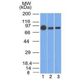 Western blot testing of human 1) A431, 2) A549 and 3) MCF7 cell lysate with Beta Catenin antibody (c