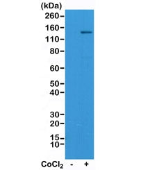 HIF1A Antibody / HIF-1 alpha