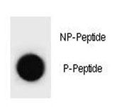 Dot blot analysis of phospho-p21 antibody. 50ng of phos-peptide or nonphos-peptide per dot were spot