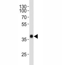 SOX2 Antibody