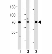 Western blot analysis of lysate from (1) HeLa, (2) HepG2 and (3) human placenta tissue lysate using ATF6 beta antibody at 1:1000. Predicted molecular weight: 75~90kDa.