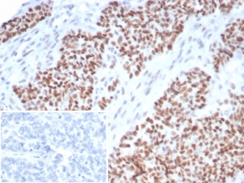 p53 Antibody / TP53