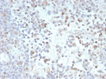 PRAME Antibody / OIP-4