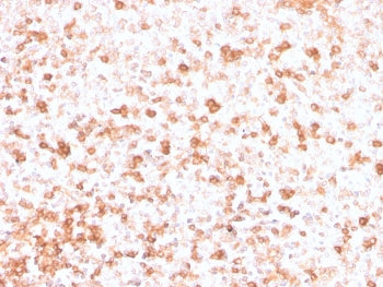 IHC staining of FFPE human tonsil with recombinant Lambda Light Chain antibody (clone rLLC/3777). HI