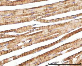 NEBL Antibody / Nebulette