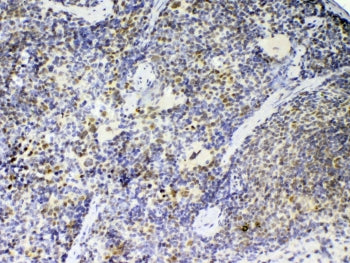 Ptpn22 Antibody / Protein tyrosine phosphatase non receptor type 22
