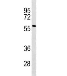 ACSF2 antibody western blot analysis in human Jurkat lysate. Predicted molecular weight ~68 kDa.