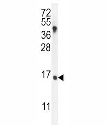 IGKV A18 Antibody