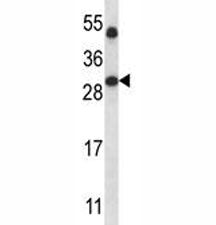 SIRT5 Antibody