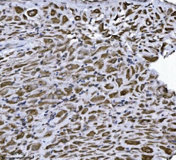 IHC staining of FFPE human placental tissue with ERLIN2 antibody. HIER: boil tissue sections in pH8 