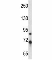 Irak1 Antibody