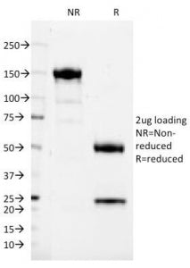 SDS-PAGE Analysis of Purified, BSA-Free CD37 Antibody (clone IPO-24). Confirmation of Integrity and 