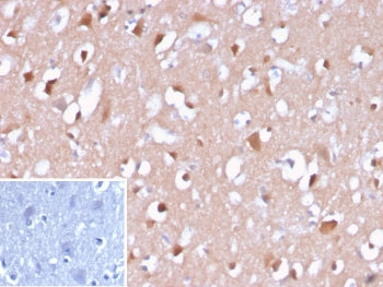 IHC staining of FFPE human brain tissue with Amyloid beta antibody (clone APP/3667). Inset: PBS used