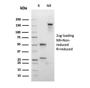 Desmocollin 2/3 Antibody
