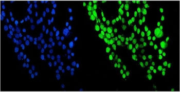 NUP214 Antibody / Nucleoporin 214