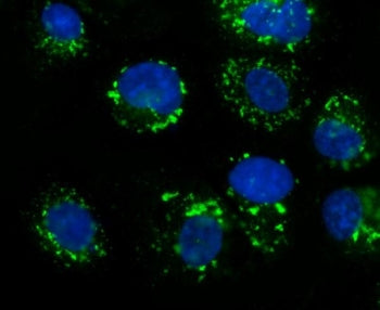 GOLPH2 Antibody / GOLM1