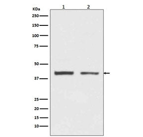 hnRNP C1/C2 Antibody / HNRNPC
