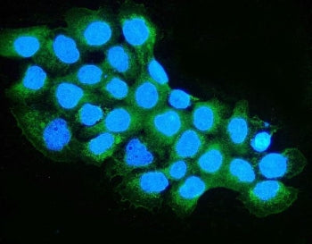 OXCT1 Antibody / SCOT