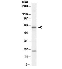 BMPR1A Antibody