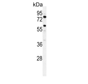 ACSBG2 Antibody / BGR