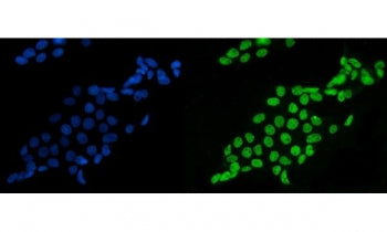 Immunofluorescent staining of FFPE human A431 cells with Splicing factor 1 antibody (green) and DAPI